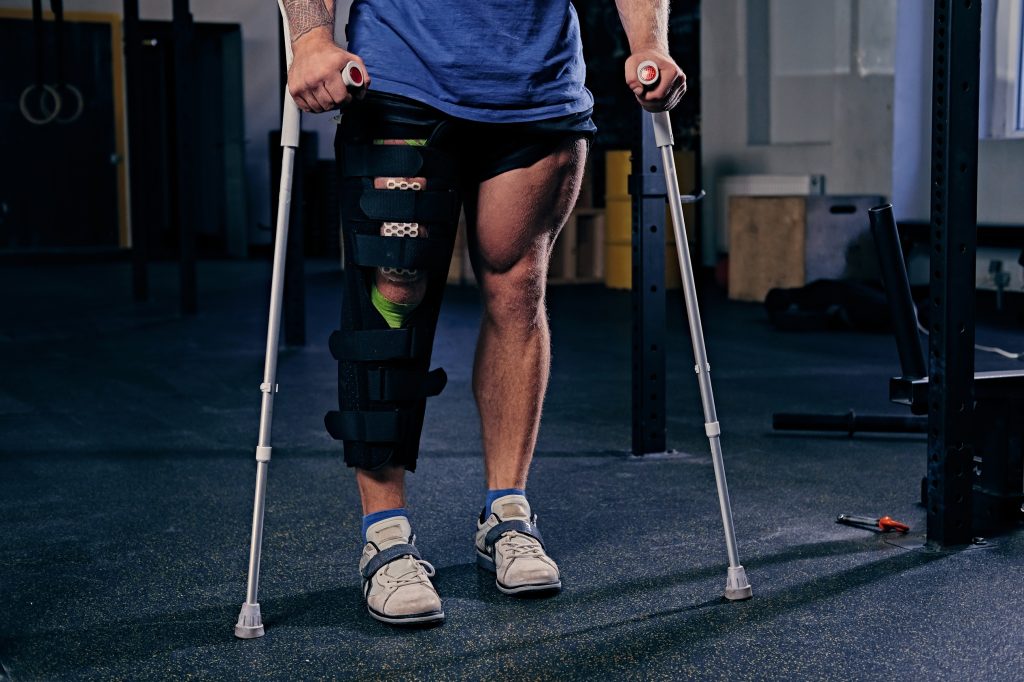 A medical diagram showing a three-point pressure system of an offloading knee brace shifting weight away from a damaged knee compartment.