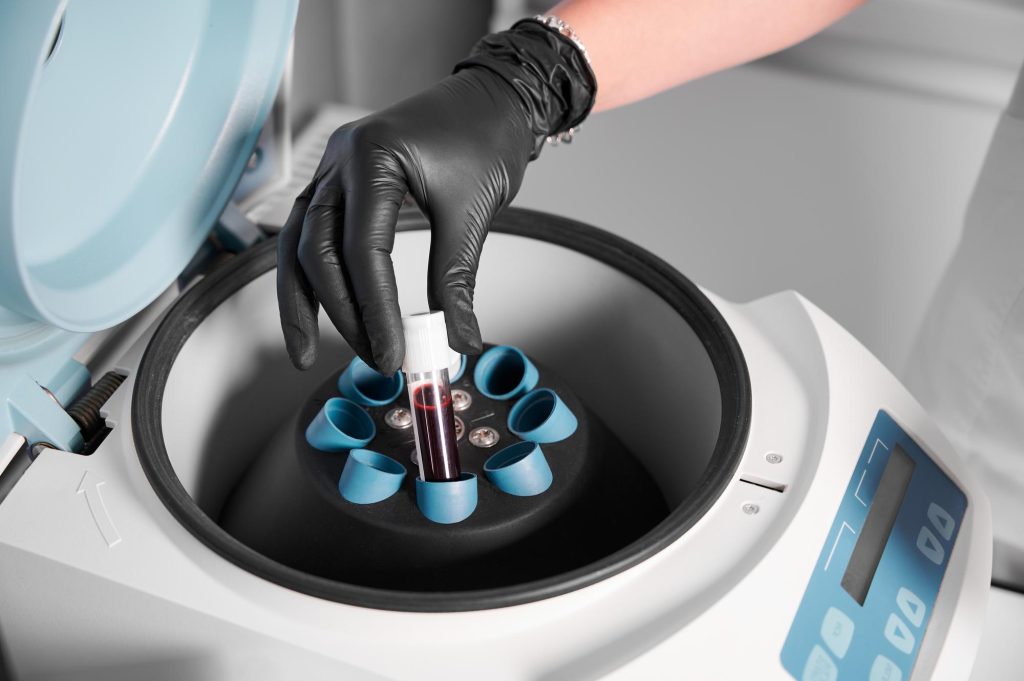 A medical professional wearing black gloves placing a vial of blood into a laboratory centrifuge machine for PRP preparation.