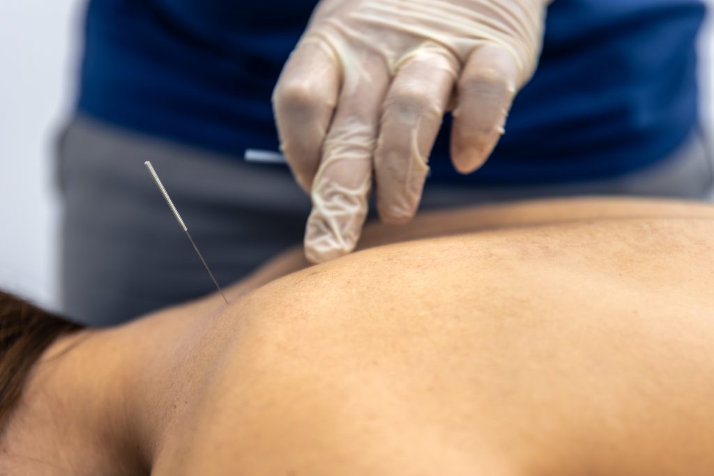 A close-up of a medical professional administering a precise trigger point injection into a taut band of muscle to release a painful "knot" in a patient's back.