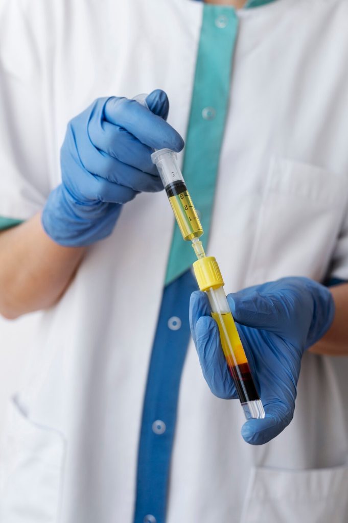 PRP therapy benefits for joint pain and injury recovery
