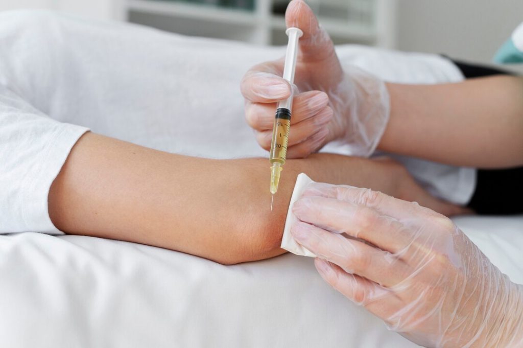 PRP therapy for ligament injuries near Huntersville NC