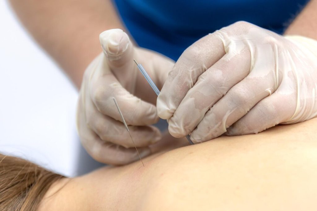 Physical therapy with trigger point injections for muscle pain
