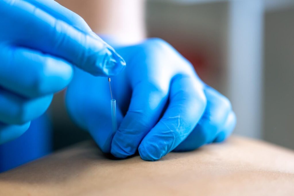 Trigger point evaluation for muscle pain in Huntersville NC