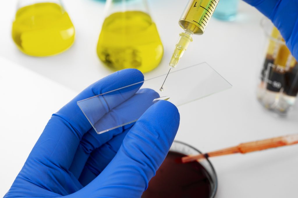 How PRP therapy is made in Mount Holly, NC