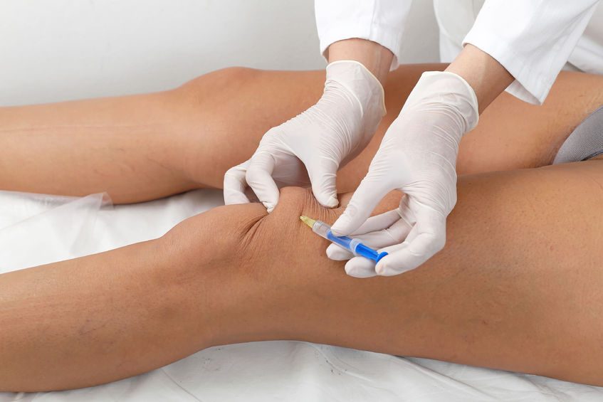 Hyaluronic acid injections for knee osteoarthritis