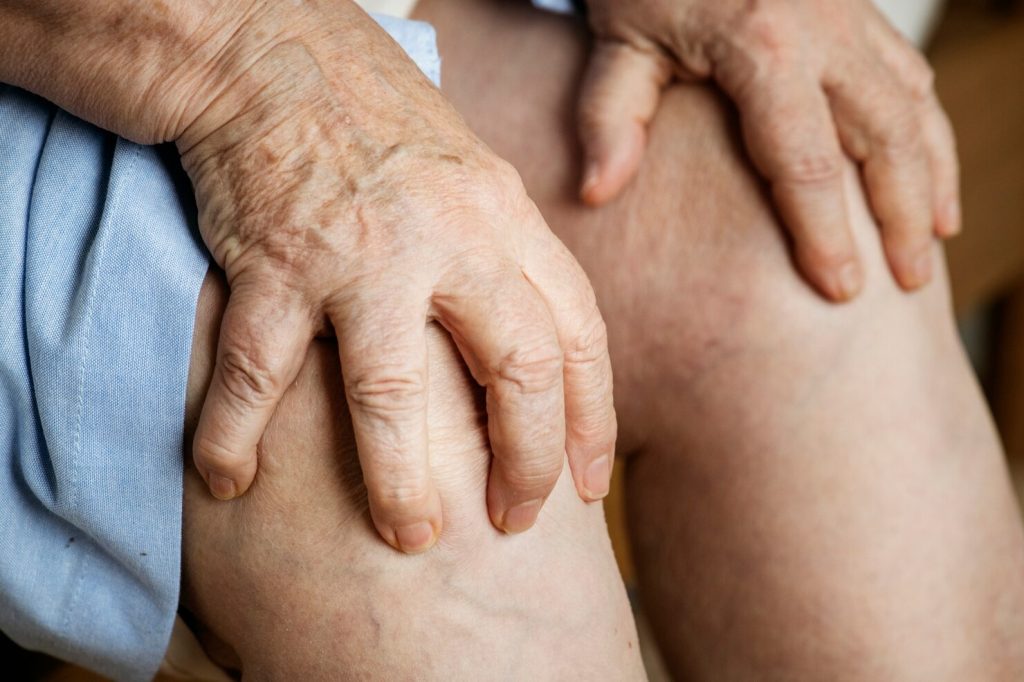 Knee arthritis flare-up support with hyaluronic acid injections