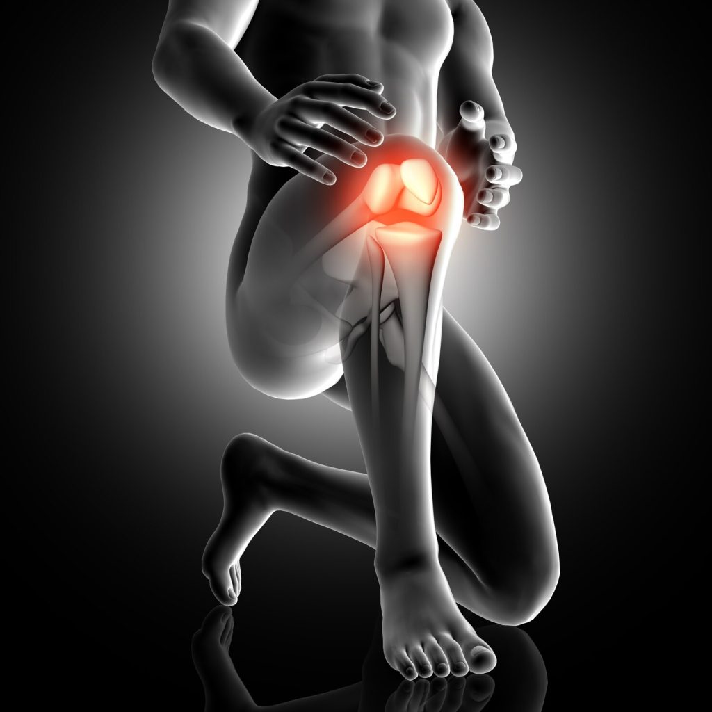 Bone-on-Bone Arthritis Concord NC