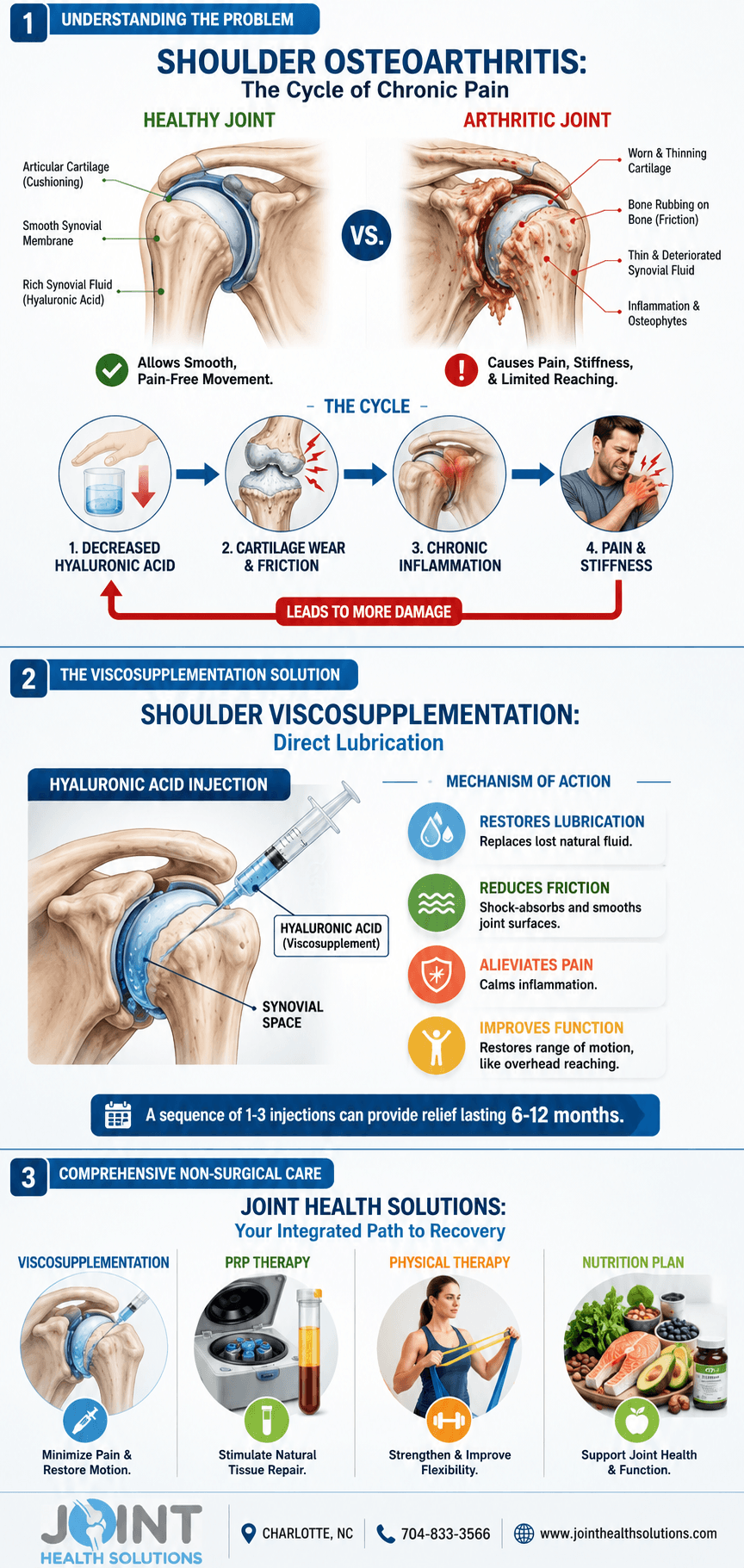Viscosupplementation